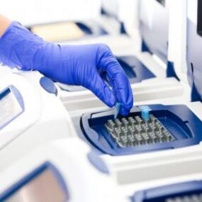 Ανάλυση PCR